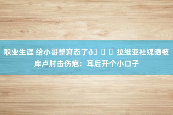 职业生涯 给小哥整窘态了😅拉维亚社媒晒被库卢肘击伤疤：耳后开个小口子